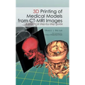 3D Printing of Medical Models from CT-MRI Images: A Practical step-by-step guide - Hardcover