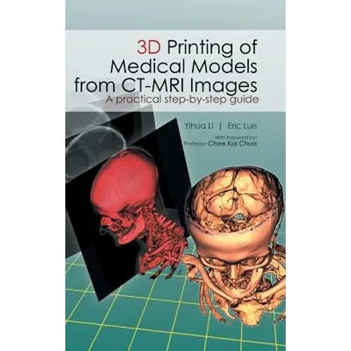 3D Printing of Medical Models from CT-MRI Images: A Practical step-by-step guide - Hardcover