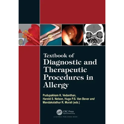 Textbook of Diagnostic and Therapeutic Procedures in Allergy - Paperback