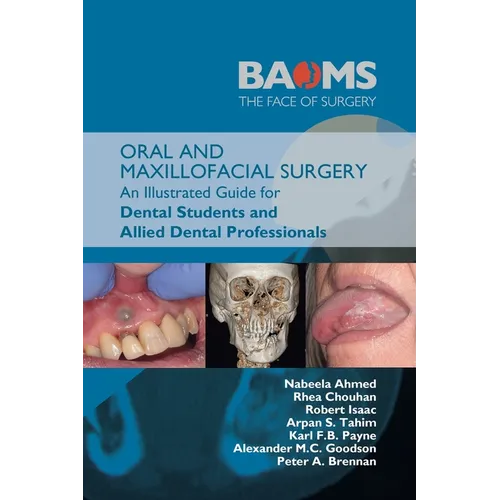 Chirurgie buccale et maxillo-faciale : Guide illustré pour les étudiants en médecine dentaire et les professionnels des soins dentaires - Broché