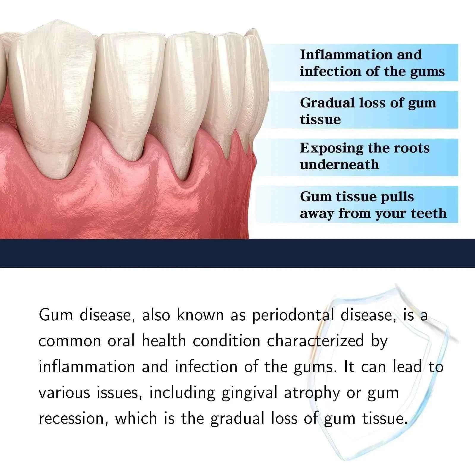 Jaysuing 30ml Repair Gums Serum Relieve Tooth Allergy Gum Pain Tooth Stain Cleaning Repair Gingival Regrowth Dental Care Drop