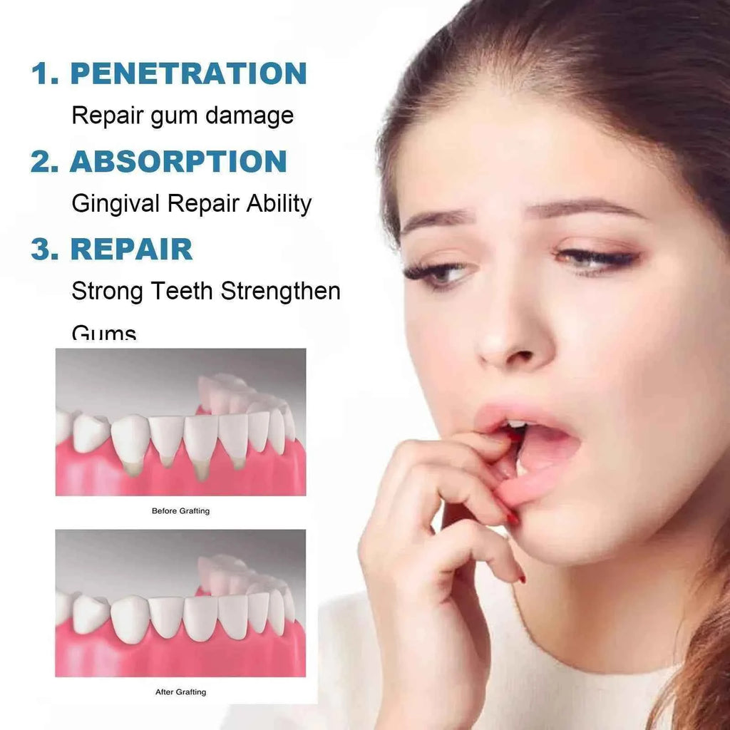 Jaysuing 30ml Repair Gums Serum Relieve Tooth Allergy Gum Pain Tooth Stain Cleaning Repair Gingival Regrowth Dental Care Drop