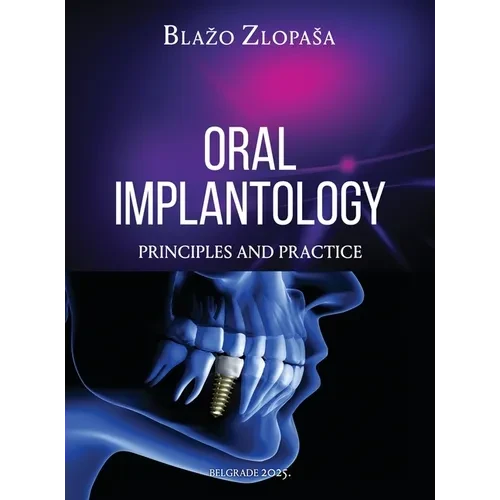 Oral Implantology: Principles and Practice - Hardcover
