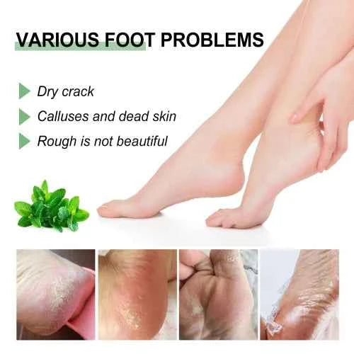 OUHOE Peppermint  Repair The Prevent Weather-Shack Desquamate Cracked Heels Moisturize Foot Care Cream