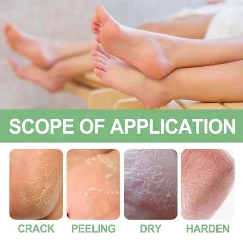 OUHOE Peppermint  Repair The Prevent Weather-Shack Desquamate Cracked Heels Moisturize Foot Care Cream