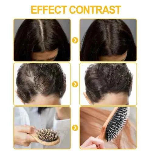 Jaysuing Ball Massage Prevents Hair Loss Thickening  And Scalp Irritation Care Solution