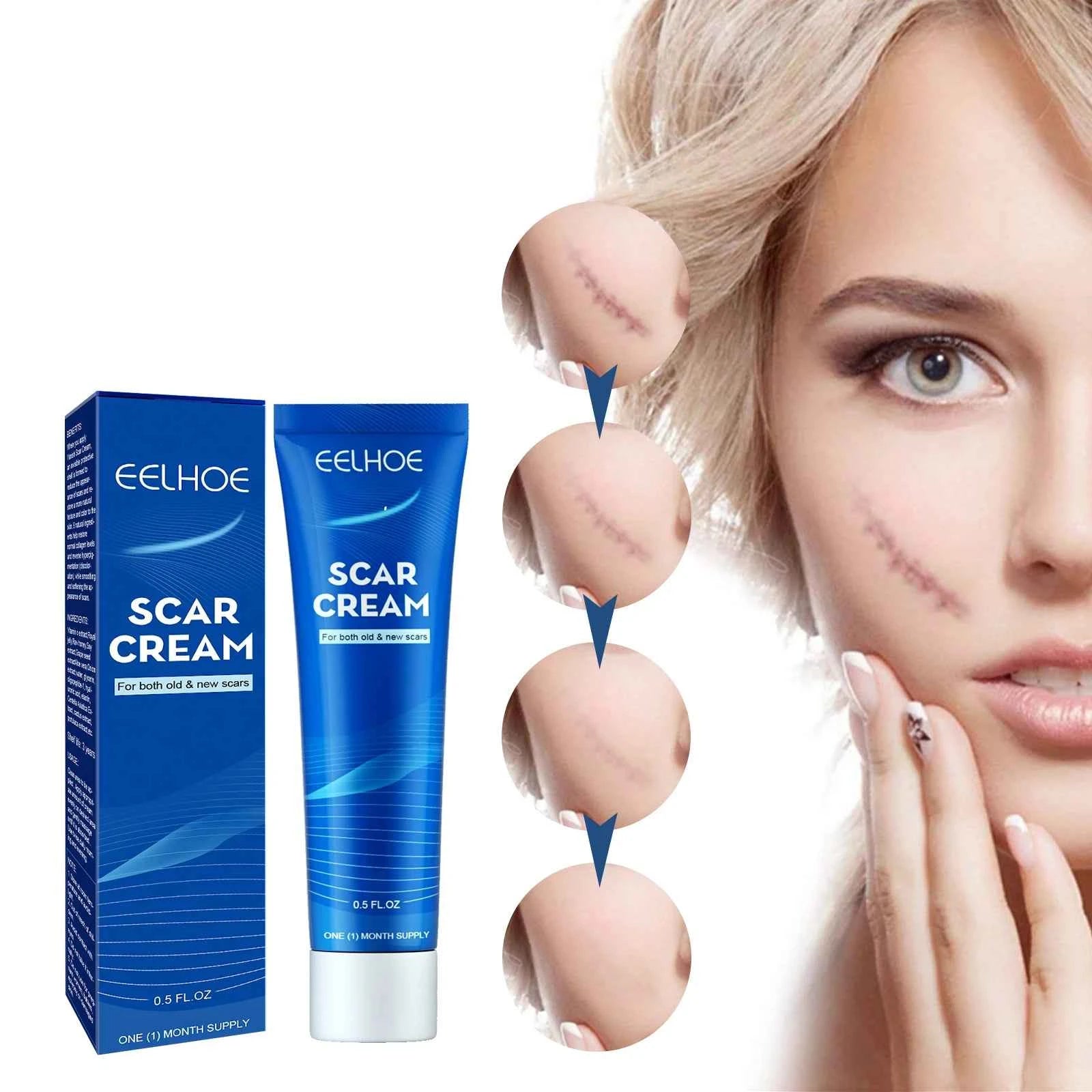 EELHOE Scar Care Cream for Gentle Body External Moisturizing Smooth Skin Care