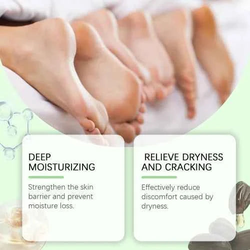 Wiyun Hand Urea Hydrates Moisturizes Skin To Prevent Cracking And Drying Foot Cream