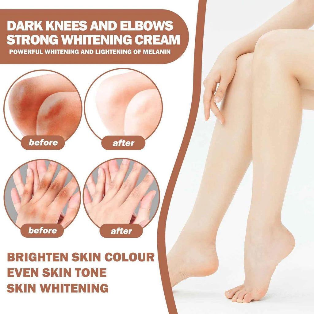 EELHOE Body Cream Moisturizing Dull Skin Whitening Repair Cream for Joints and Elbows Joint Whitening Cream