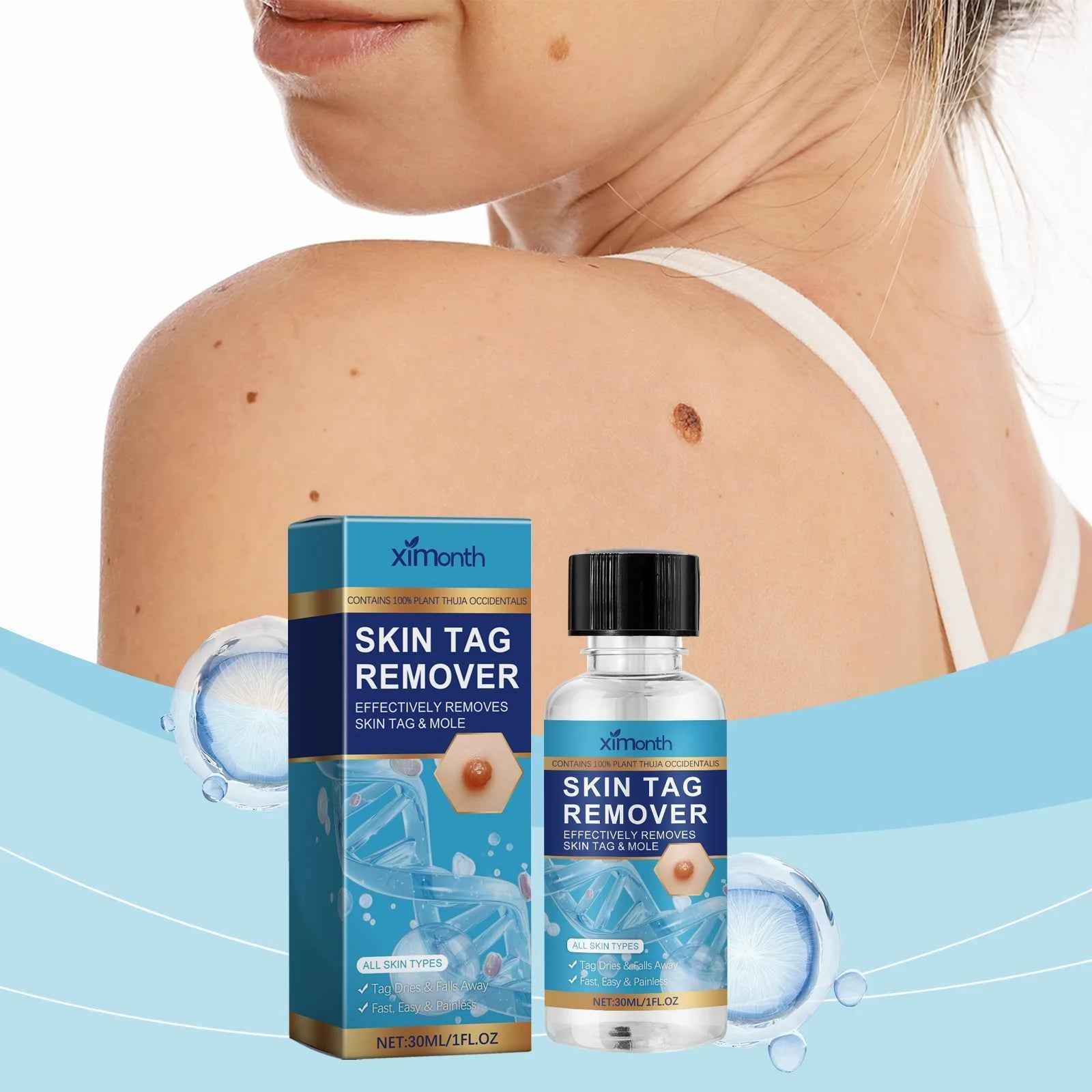 Ximonth Keyu Liquid Scar Care Effective Hand and Foot Skin Cleansing Repair Smoothness Focused on Moles and Labels