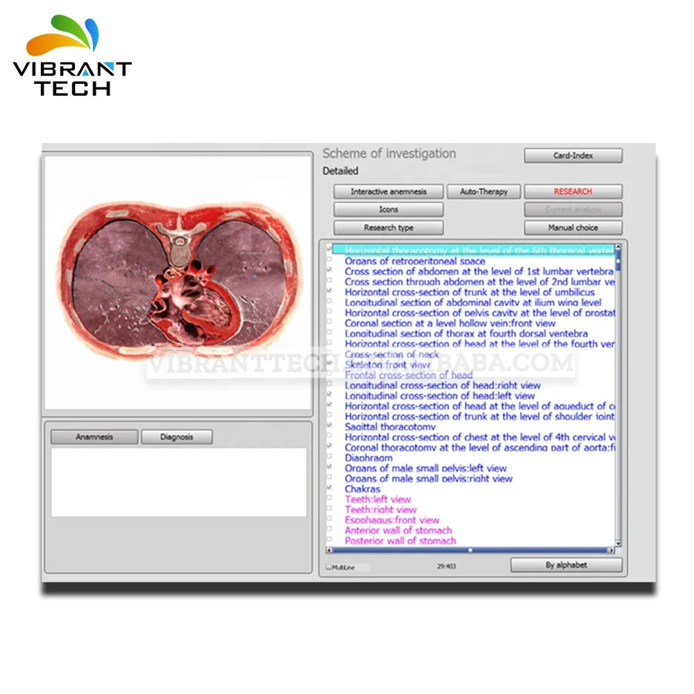 Bioresonance Diagnostics NLS System 17/18D Full Body Health Analyzer, Free Shipping