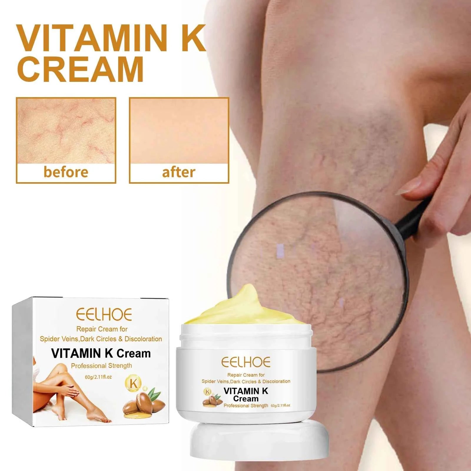 EELHOE Earthworm Leg Vein Massage Cream Vitamin K Scar Care for Sore and Swollen Legs Skin Care