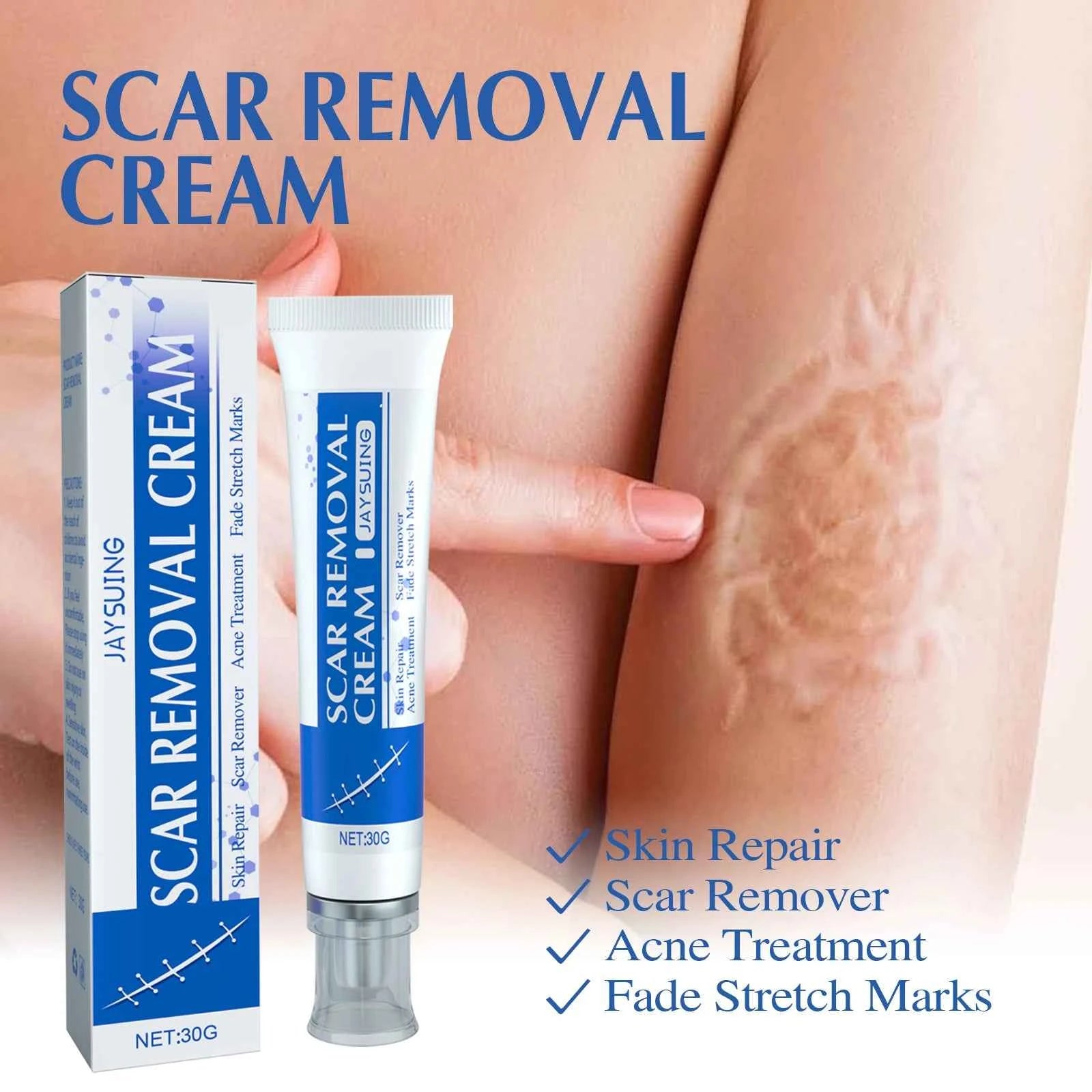 Jaysuing Scar Cream for Smooth and Firming Skin Repair Effective in Fade Scars-Key Feature in Scar Care Product Category