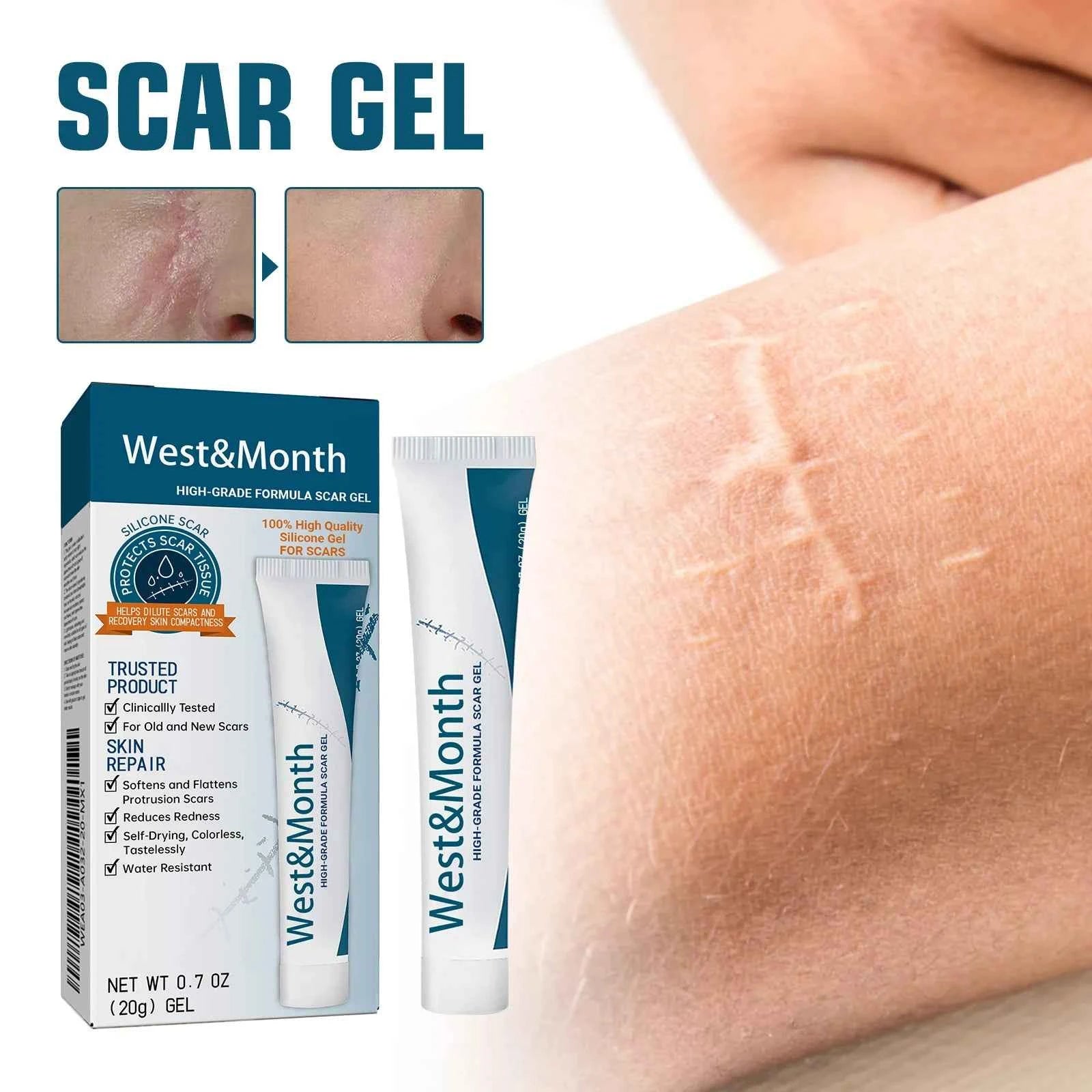 West&Month High-Grade Formula Scar Care Gel for Post-Surgery Scar Repair Pregnancy Smoothing Skin Care