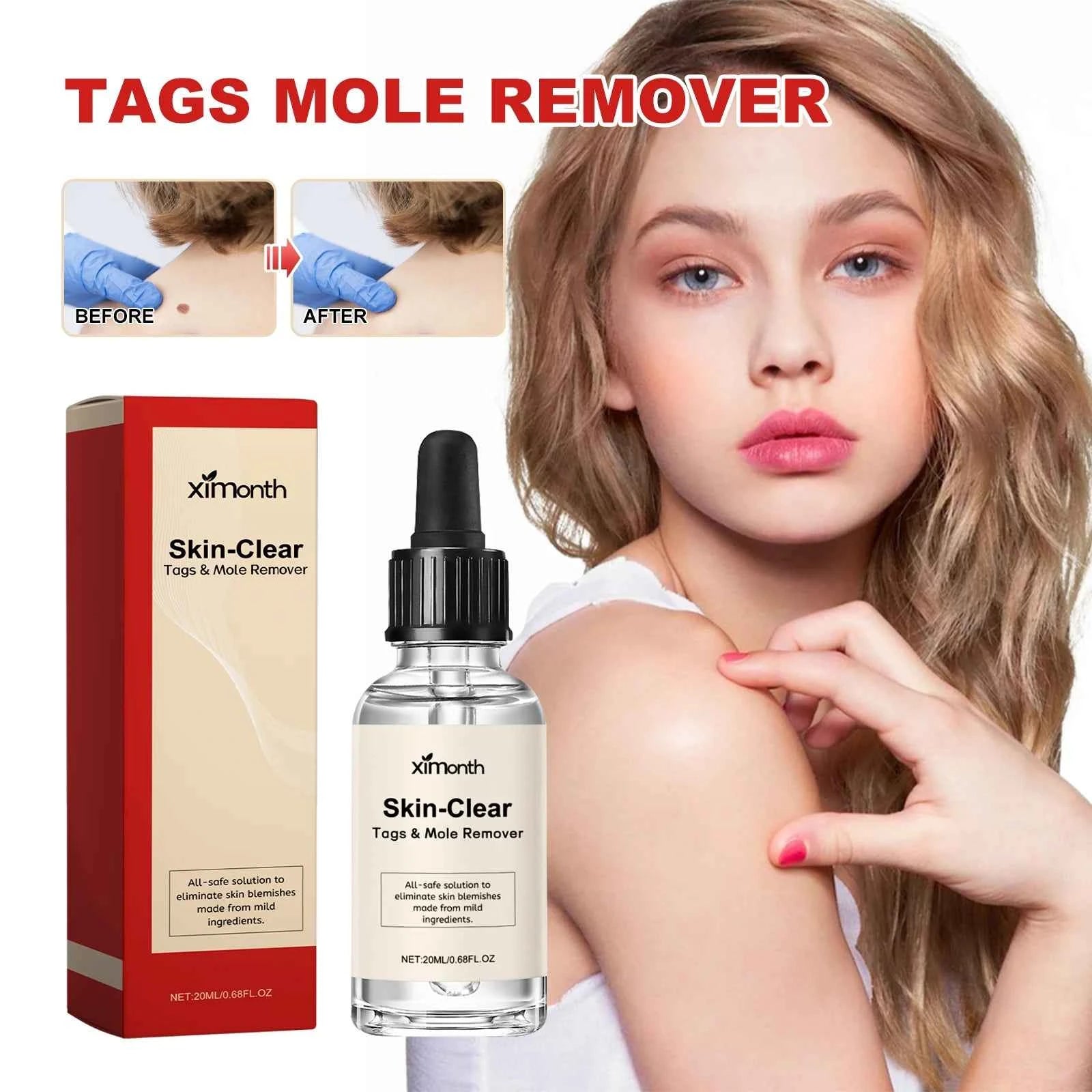 Ximonth Skin Care Essence Mole and Warts Remover Smooth Flesh Repair for Scar Care