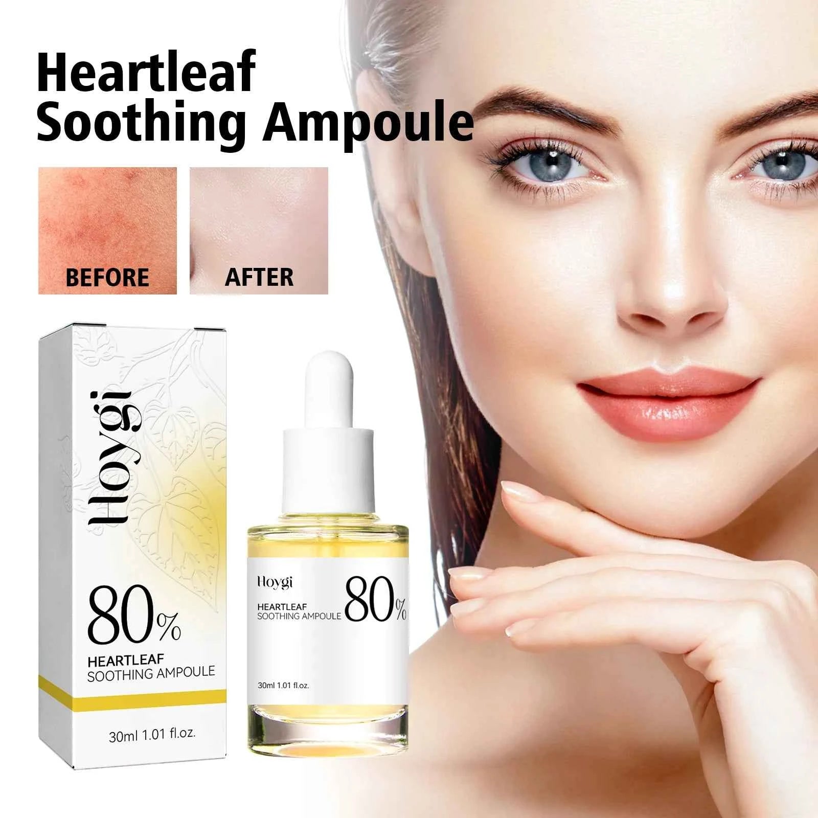 Hoygi Heartleaf Facial Essence Gentle Anti-Dryness Moisturizing Ampoule Refreshing and Non-Greasy Soothing Skin Care