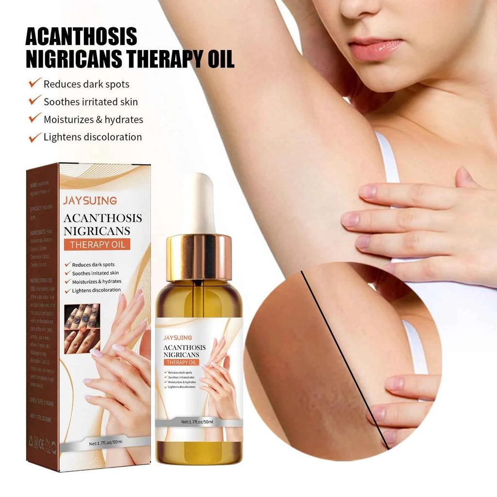 Jaysuing Moisturizing Repair Essential Oil for Acanthosis Nigricans Therapy Whitening Beauty Care for Armpit Joints Scar Care