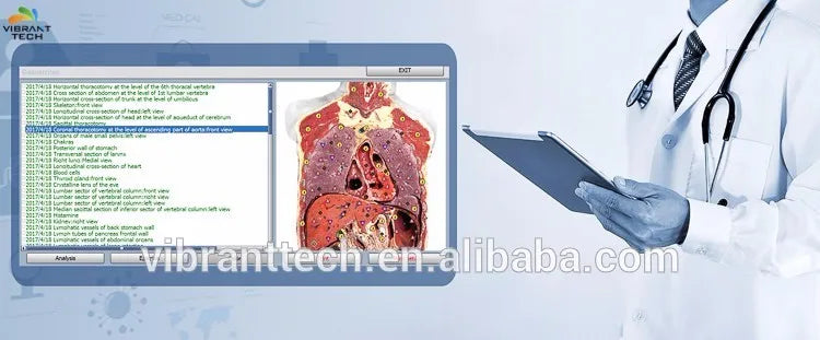 2024 New Health Assessment Equipment BIOPLASM Nls Factory Price Offer