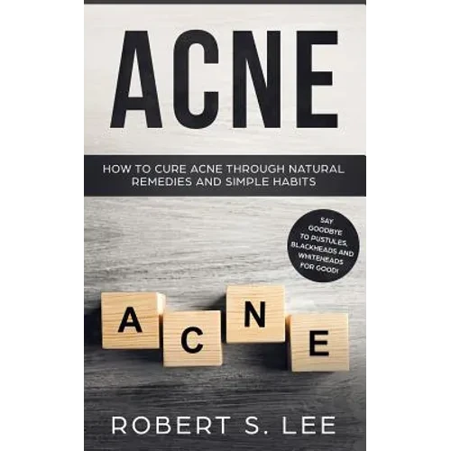 Acne: How to Cure Acne through Natural Remedies and Simple Habits. Say Goodbye to Pustules, Blackheads and Whiteheads for Good! - Paperback