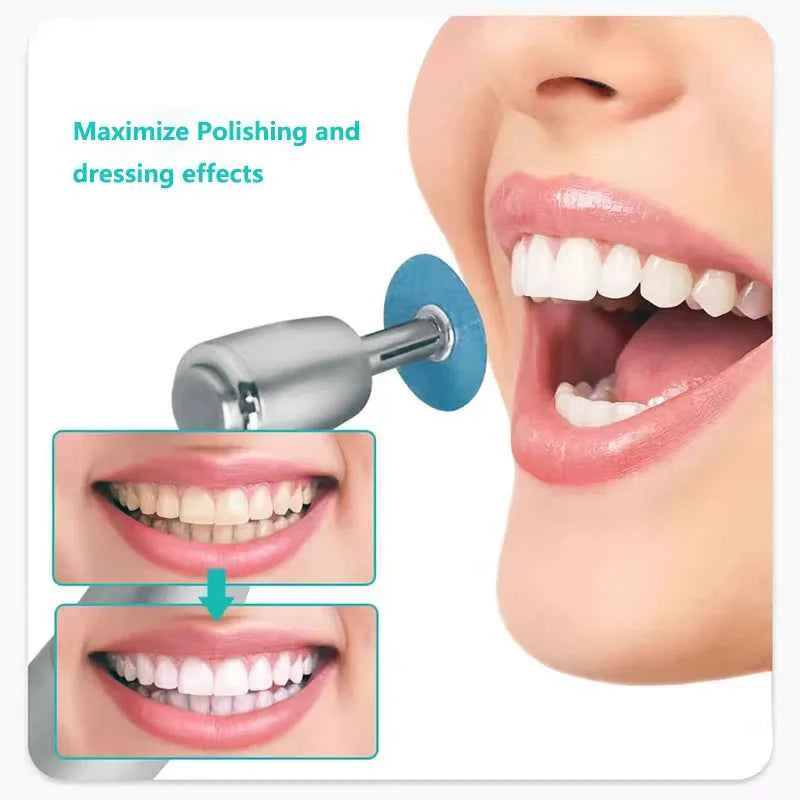 40pcs Dental Polishing Discs Holding Rod Mandrel Soflex Flexi Disc RA Shank Teeth Whitening Material Dentistry Tools Consumables