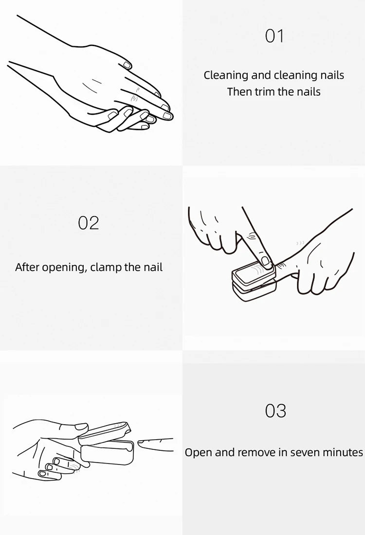 Nail Fungus Treatment Tool Fungal Nail Treatment Anti-Equipment Effectively Remove Fungal Toenail Nail Fungal Infection skincare