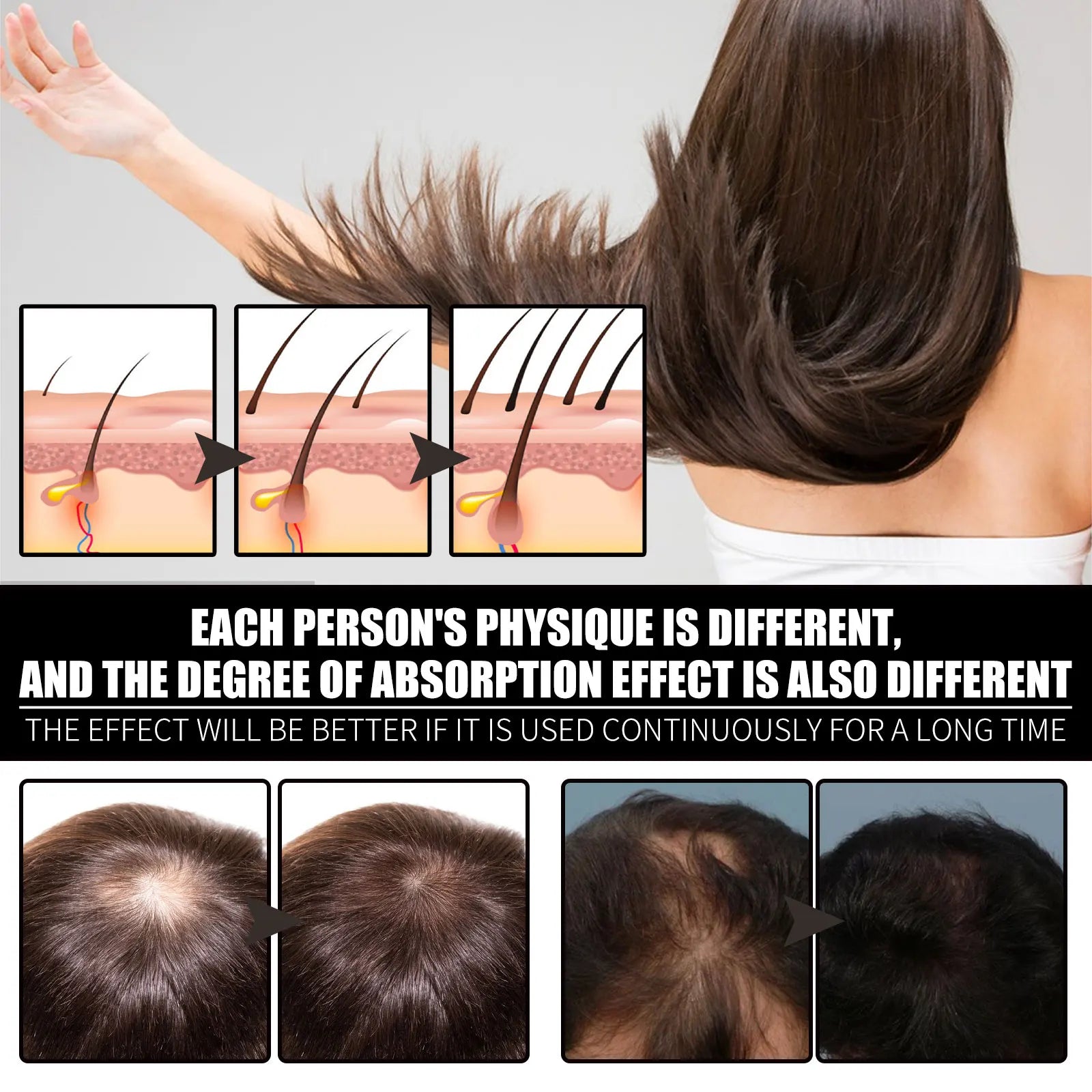 Biotin Hair Oil Collagen Scalp Serum Strengthening Treatment Natural Rosemary Ginseng Extract Thicker Volume Care For All Types