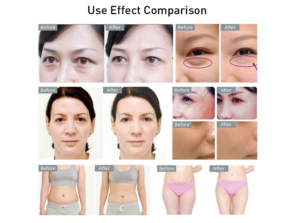 3IN1 40K Ultrasound Radiofrequency Beauty Device Massage for Shaping Tighten the Skin Burn Fat Anti-aging Whitening Beauty Tools