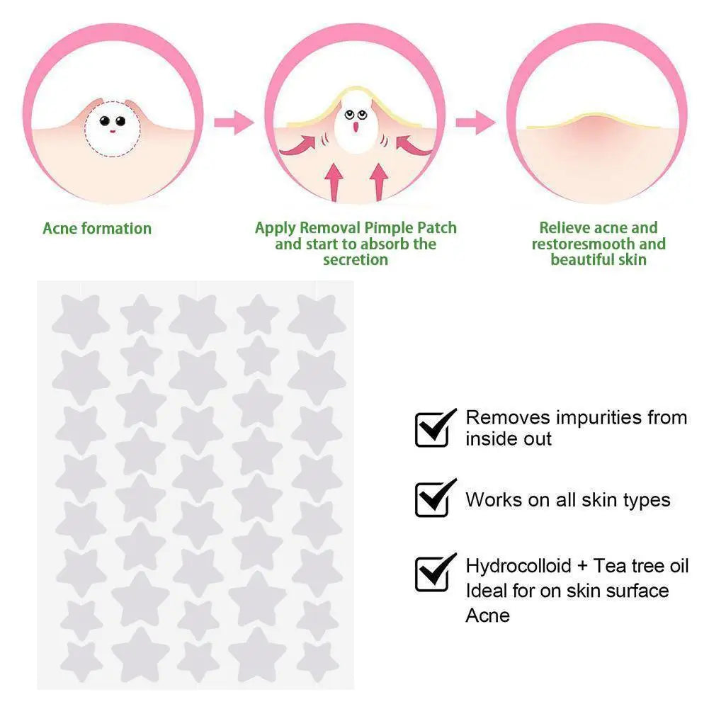 Star Pimple Patches For Acne – Cute Invisible Spot Covers