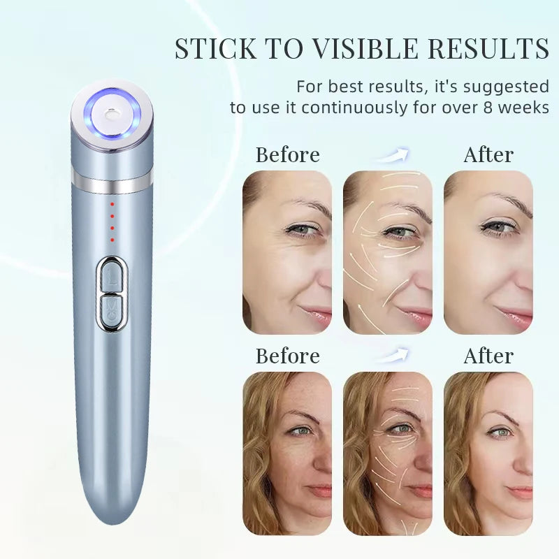 EMS Eye Massager Anti-aging Beauty Instrument Eye Care Massage Tool Wrinkle Removal Face Lifting Beauty Device Home Use