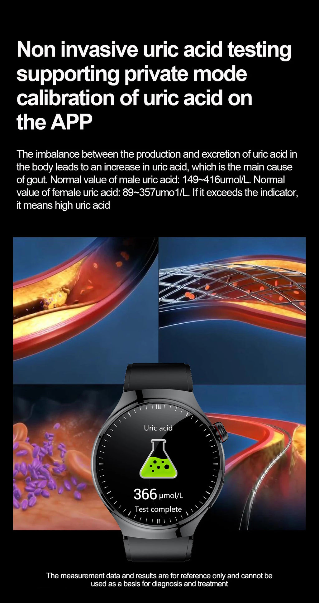 2025 High precision ECG Uric Acid Blood Fat Smart Watch Men Body Fat Blood pressure Heart rate Pulse Health  Watches