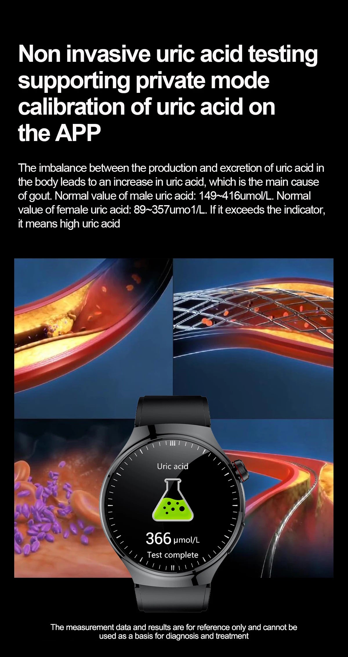 2025 High precision ECG Uric Acid Blood Fat Smart Watch Men Body Fat Blood pressure Heart rate Pulse Health  Watches