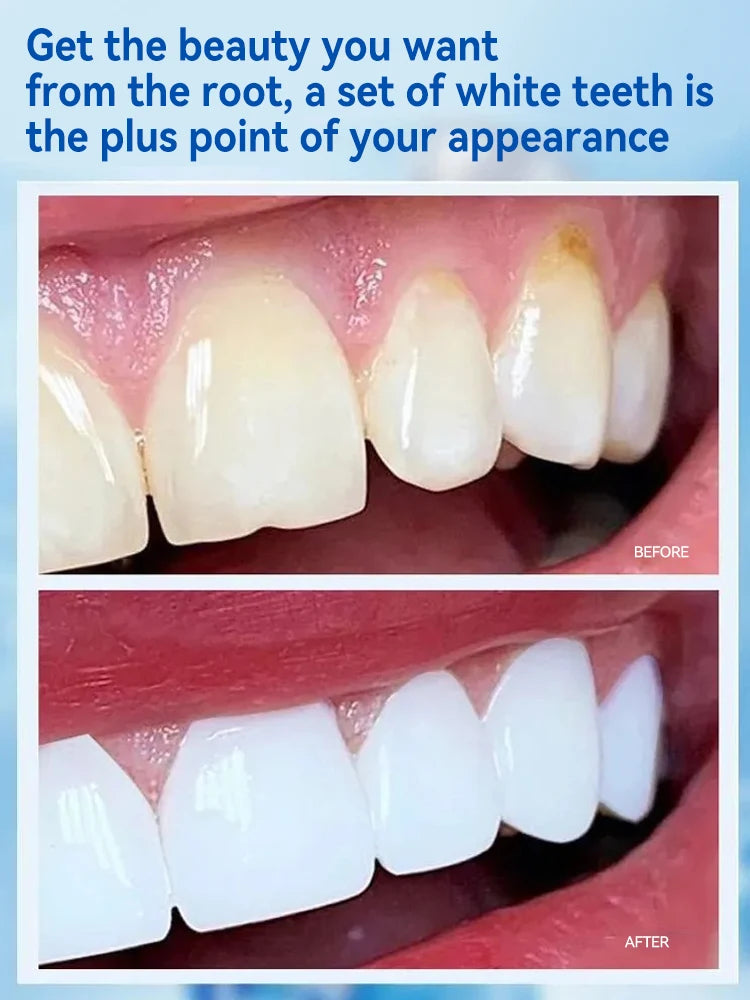 Free shipping,Teeth cleaning care tools, oral foam,Free shipping