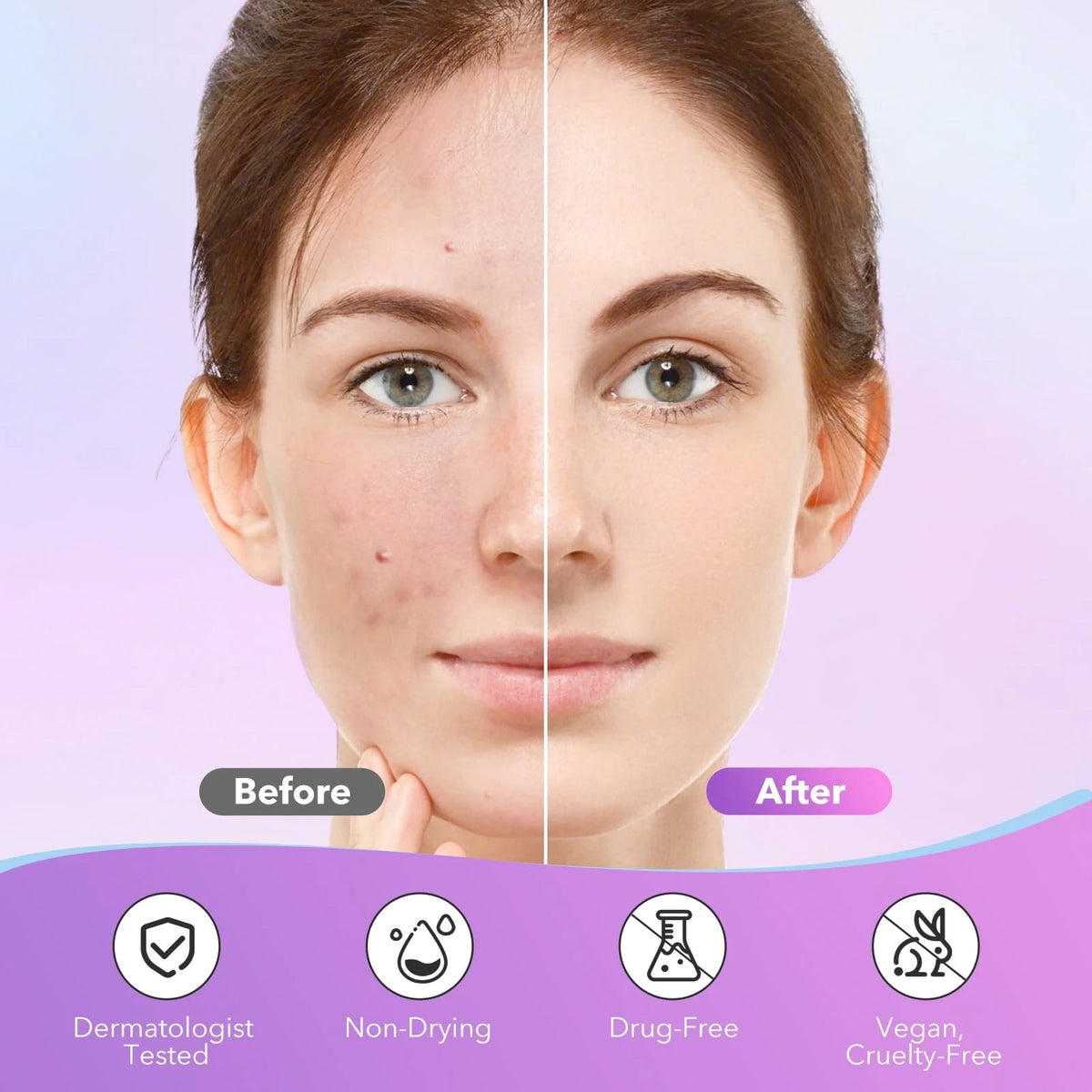 Star-Shaped Pimple Patches Set – Gentle Multi-Color Acne Cover