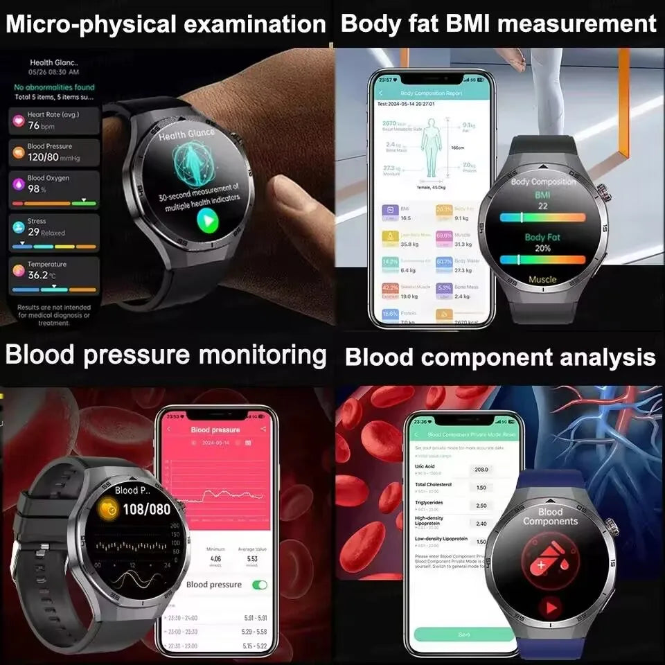 2025 New ECG+PPG Three High treatment Smart Watch Lipids Uric acid Blood pressure Smartwatch Men NFC Sport HD Call Health Clock