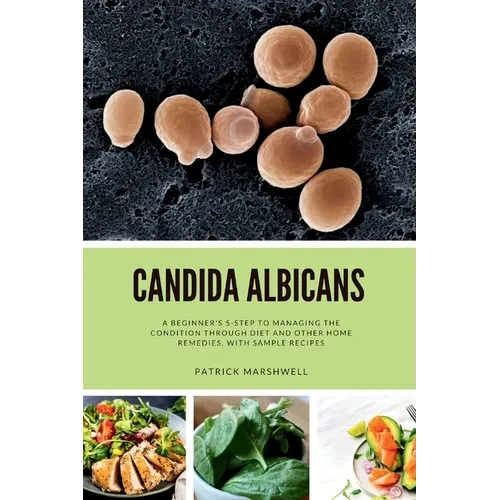 Candida Albicans: A Beginner's 5-Step to Managing the Condition Through Diet and Other Home Remedies, With Sample Recipes - Paperback