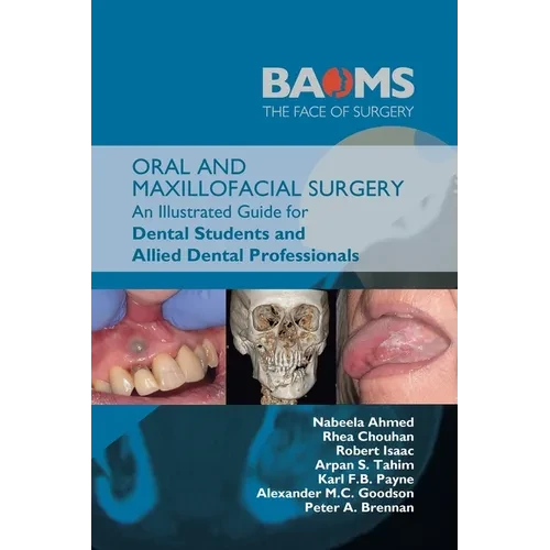 Oral and Maxillofacial Surgery: An Illustrated Guide for Dental Students and Allied Dental Professionals - Paperback